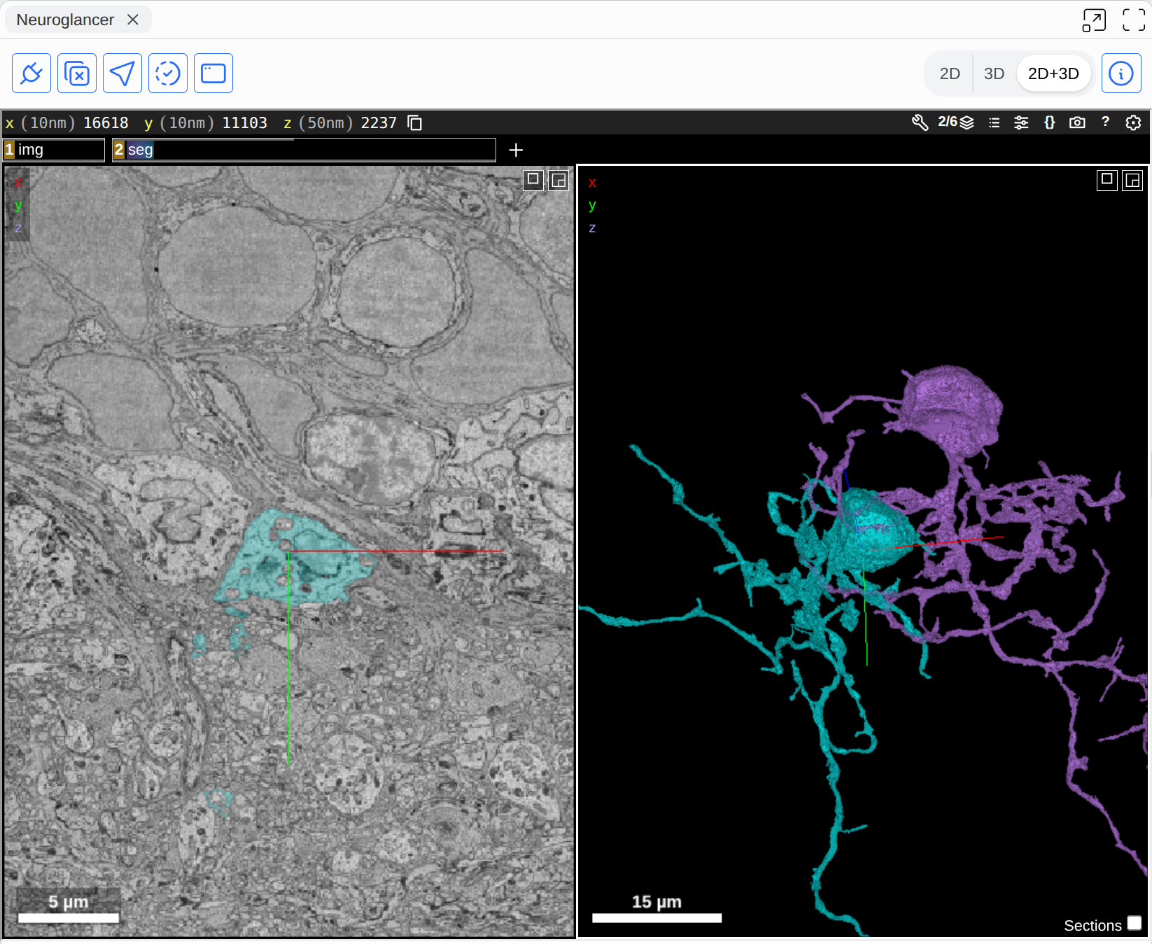 Neuroglancer 3D Viewer